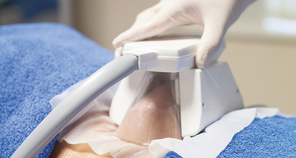 How Fat Freezing and HIFU Work Together? 2 Multiple Areas in One Session HIFU and Fat Freezing Wellingborough