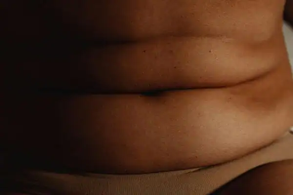 The Hidden Connection: How Stress Shapes Your Fitness and Body Composition 3 image of what stress can do on the stomach area and how Lipo 360 Wellingborough can help to change your body shape.